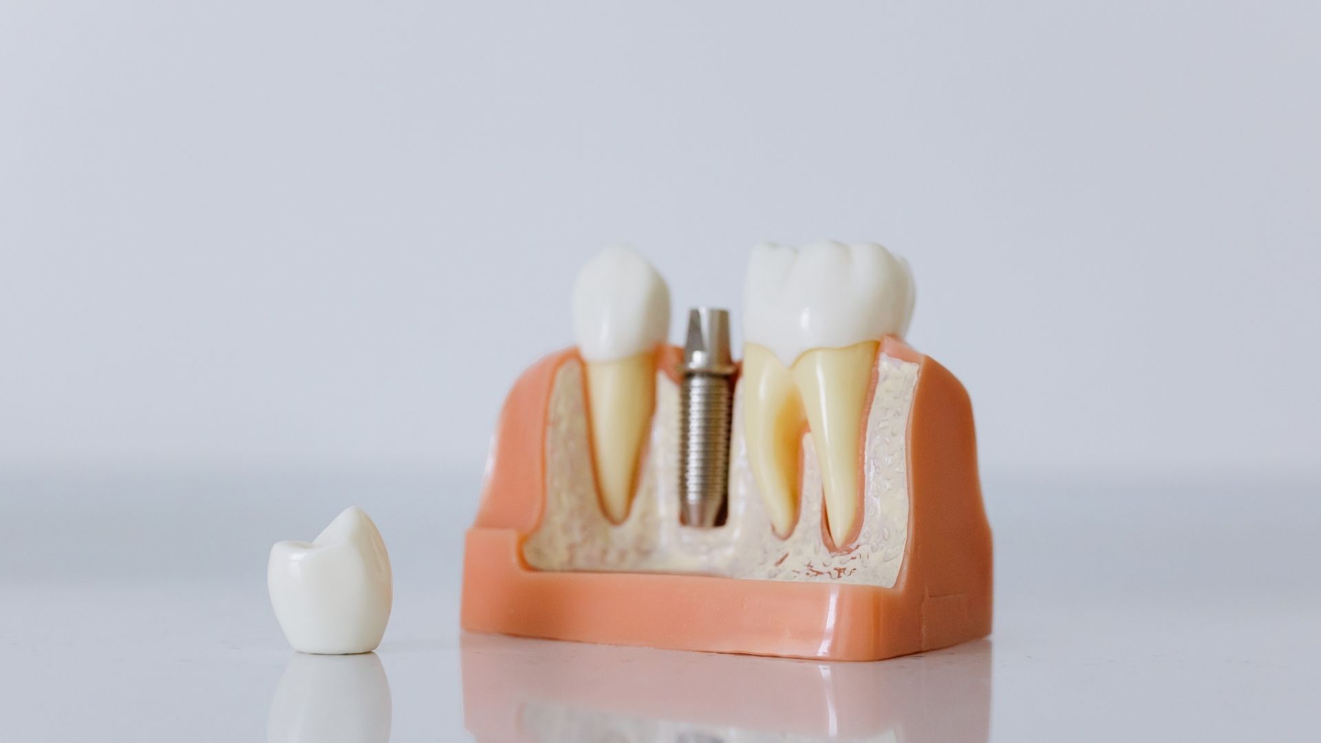 fog implantátum kilökődés tünetei